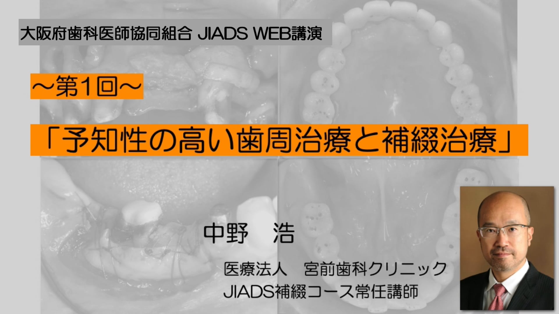 第1回「予知性の高い歯周治療と補綴治療」　講師：中野 浩先生