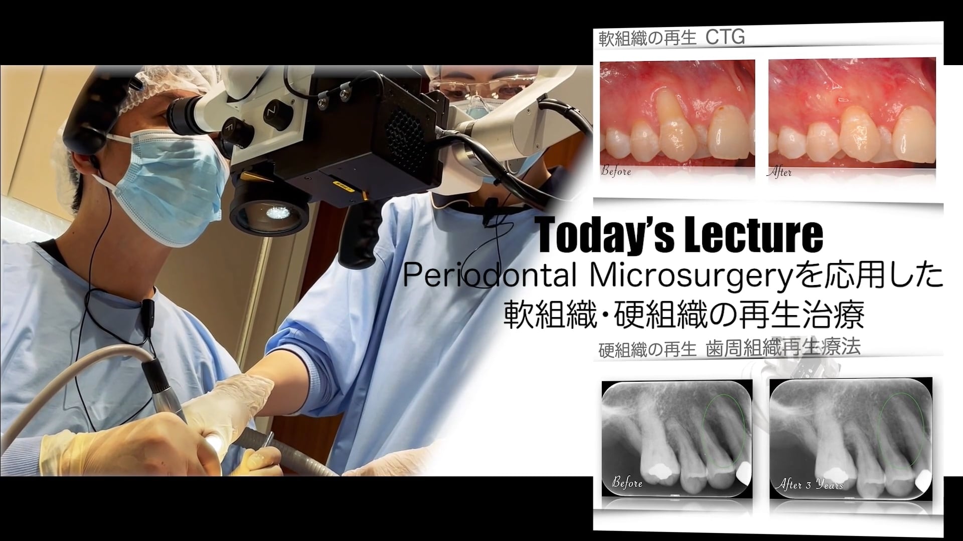 第3回「Periodontal microsurgeryを応用した軟組織・硬組織の再生治療」　　　　　講師：富塚 佳史先生