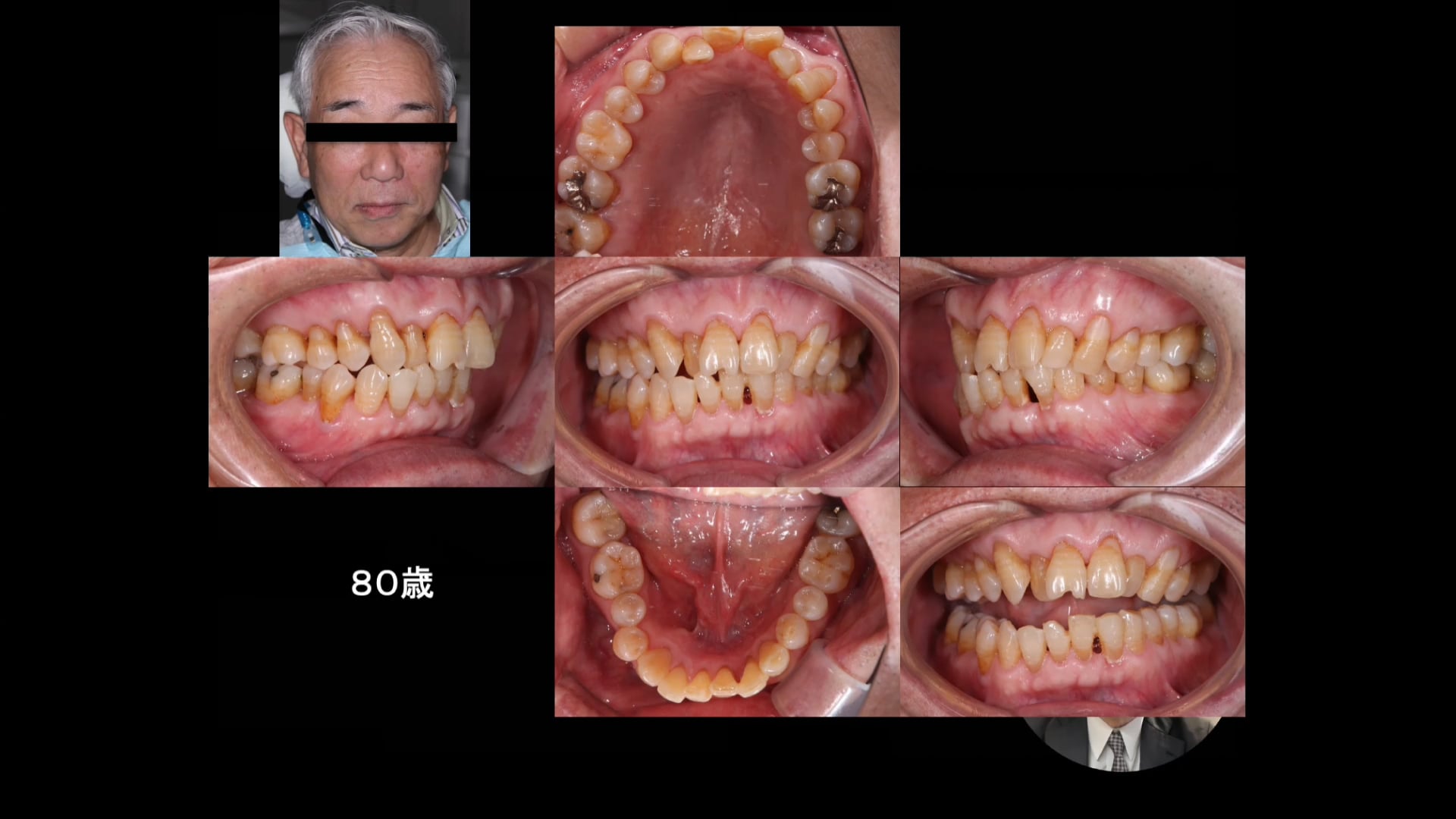 「骨格 歯列から読み解く 診断の本質＜Part.3＞」講師：酒井志郎先生