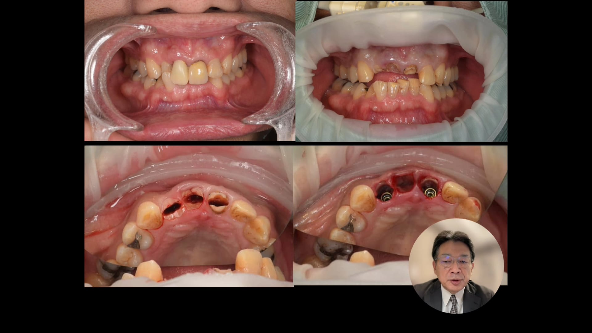「骨格 歯列から読み解く 診断の本質＜Part.2＞」講師：酒井志郎先生