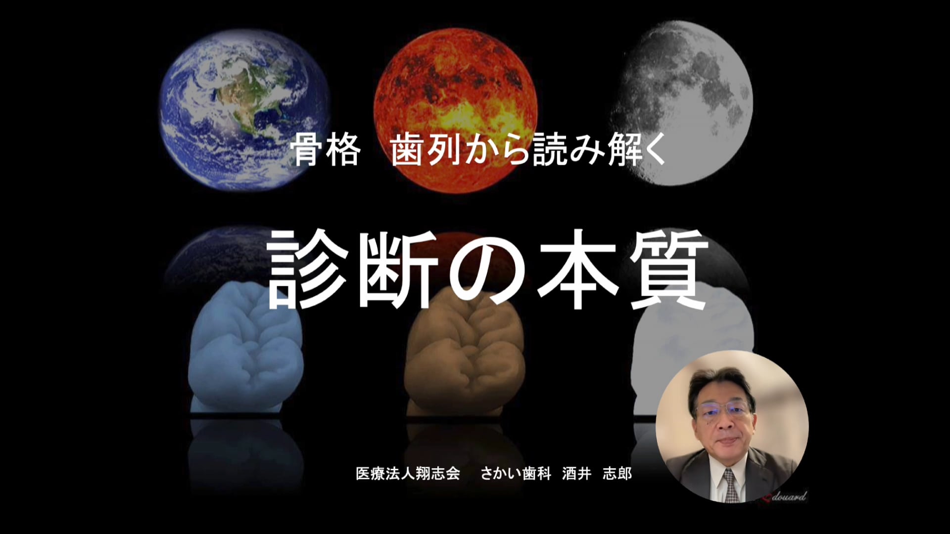 「骨格 歯列から読み解く 診断の本質＜Part.1＞」講師：酒井志郎先生